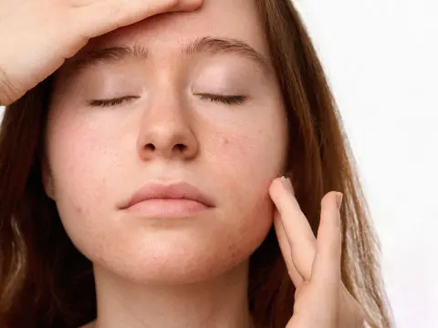 Stress Finnar - Varför de uppstår & vad som hjälper