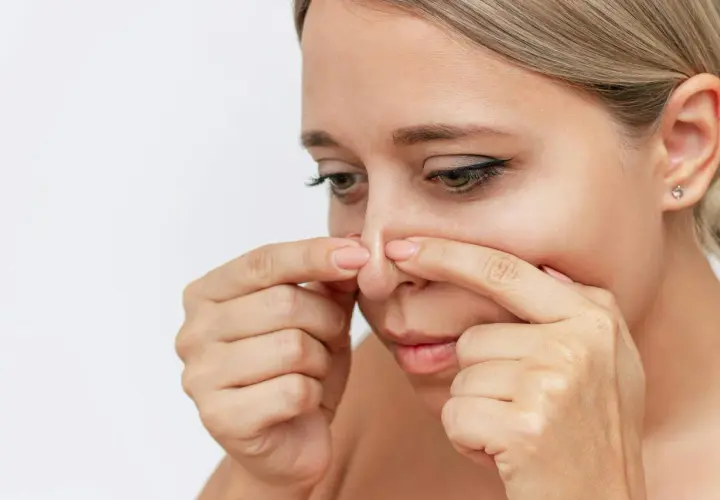 En kvinna använder fingrarna för att ta bort inkapslade pormaskar på näsan.