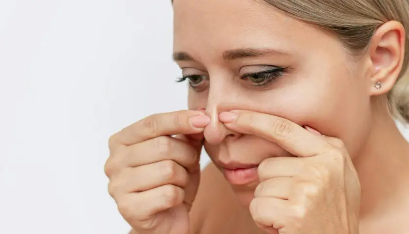 En kvinna använder fingrarna för att ta bort inkapslade pormaskar på näsan.