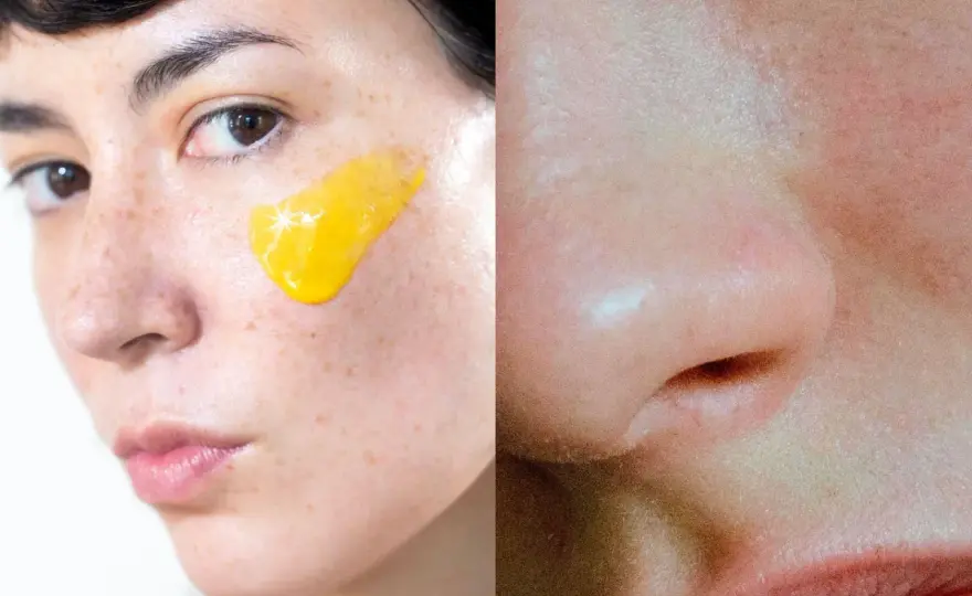 Retinol vid rosacea - När är det säkert att använda?