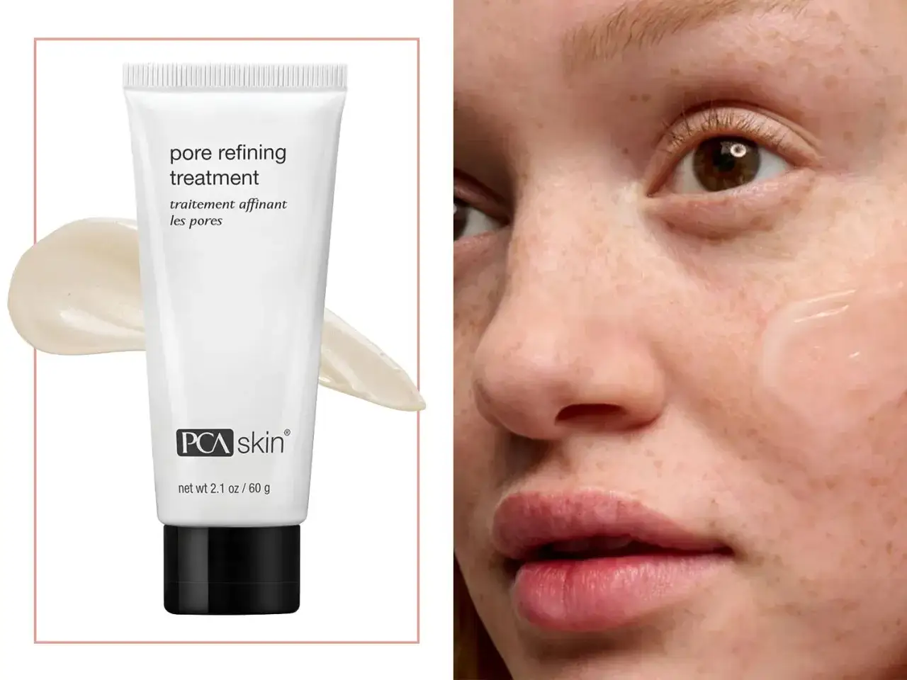PCA Skin Pore Refining Treatment. En guide till hur man f&aring;r bort porer med denna produkt.