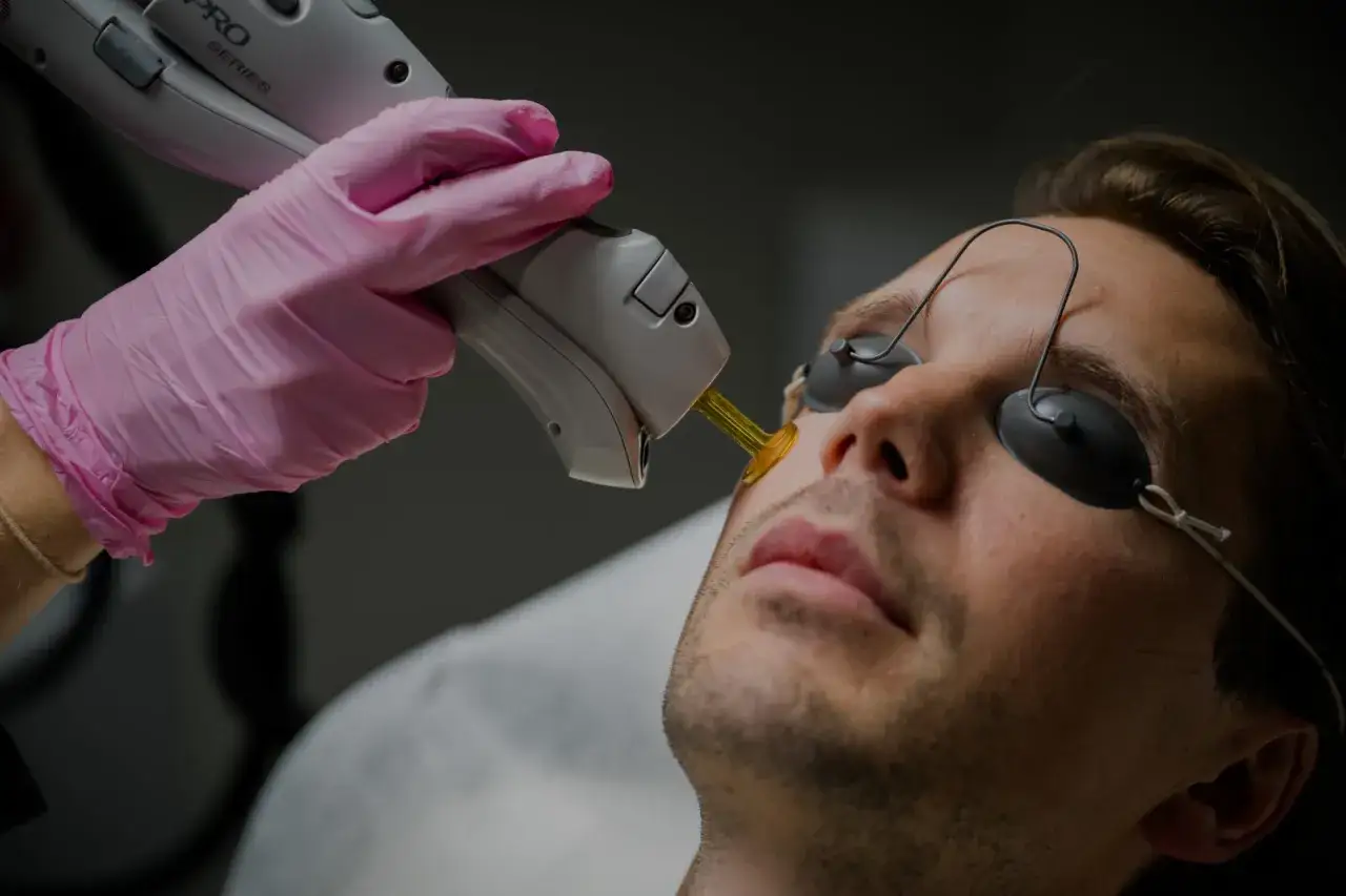 Man får behandling för att ta bort hår i ansiktet permanent med laser.